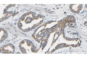 ABIN6277640 at 1/100 staining Human prostate tissue by IHC-P. (Asparagine Synthetase antibody  (N-Term))
