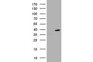 Image no. 1 for anti-Proliferating Cell Nuclear Antigen (PCNA) antibody (ABIN1500061) (PCNA antibody)