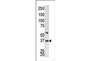 Western Blotting (WB) image for anti-Twinfilin, Actin-Binding Protein, Homolog 2 (Drosophila) (TWF2) (C-Term) antibody (ABIN359355)