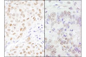 anti-Cleavage Stimulation Factor, 3' Pre-RNA, Subunit 3, 77kDa (CSTF3) (AA 667-717) antibody