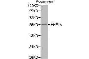 Western Blotting (WB) image for anti-HNF1 Homeobox A (HNF1A) antibody (ABIN1873058) (HNF1A antibody)
