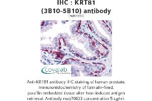 Image no. 2 for anti-Keratin 81 (KRT81) (AA 1-203), (full length) antibody (ABIN1723490) (KRT81 antibody  (full length))