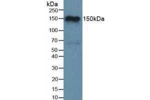 Western blot analysis of Rat Brain Tissue. (Complement Factor H antibody  (AA 975-1217))