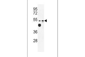 Western blot analysis of LD2 Antibody (C-term) (ABIN653167 and ABIN2842732) in WiDr, MDA-M cell line lysates (35 μg/lane).
