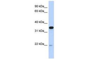 Image no. 1 for anti-Phosphotidylinositol Transfer Protein, beta (PITPNB) (AA 107-156) antibody (ABIN6743263) (PITPNB antibody  (AA 107-156))