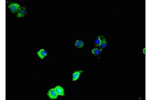 Immunofluorescent analysis of Hela cells using ABIN7160057 at dilution of 1:100 and Alexa Fluor 488-congugated AffiniPure Goat Anti-Rabbit IgG(H+L) (MAP3K8 antibody  (AA 1-300))