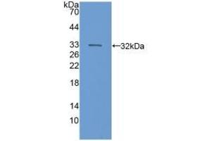 Detection of Recombinant C6, Human using Polyclonal Antibody to Complement Component 6 (C6) (C6 antibody  (AA 682-934))