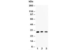 Western blot testing of AQP1 antibody and Lane 1:  rat kidney;  2: rat lung;  3: SMMC-7721 cell lysate (Aquaporin 1 antibody  (C-Term))