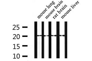 Western blot analysis of extracts from mouse lung, mouse brain, rat brain, mouse liver, using NTS Antibody.