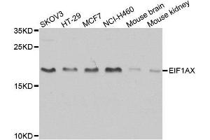 Western blot analysis of extracts of various cell lines, using EIF1AX antibody. (EIF1AX antibody  (AA 10-144))