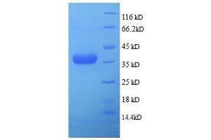 SDS-PAGE (SDS) image for Serine Peptidase Inhibitor, Kazal Type 7 (SPINK7) (full length) protein (ABIN7479575) (SPINK7/ECRG2 Protein (full length))