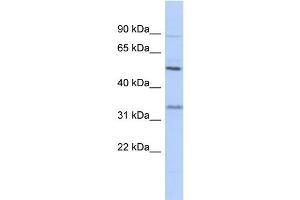 WB Suggested Anti-PRSS35 Antibody Titration: 0. (PRSS35 antibody  (N-Term))