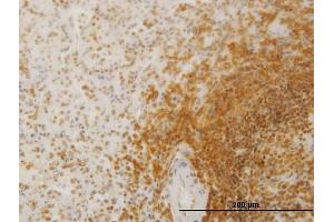 Immunoperoxidase of monoclonal antibody to SLC26A3 on formalin-fixed paraffin-embedded human spleen. (SLC26A3 antibody  (AA 503-600))