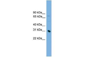 Human Jurkat; WB Suggested Anti-PRSS8 Antibody Titration: 0. (PRSS8 antibody  (Middle Region))