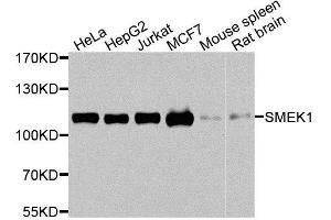 Western blot analysis of extracts of various cell lines, using SMEK1 antibody. (SMEK1 antibody  (AA 395-594))