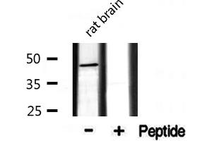 Western blot analysis of extracts from rat Brian, using CADM2 antibody.