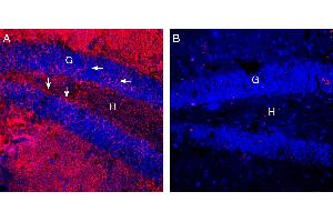 Expression of EAAT2 in mouse hippocampus.