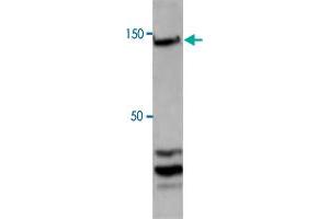 Western blot analysis of H929 nuclear cell with CTCF polyclonal antibody  at 1. (CTCF antibody  (C-Term))