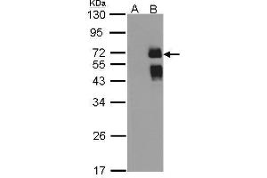 WB Image Western Blot analysis of ST6GAL1 expression in transfected 293T cell line by ST6GAL1 polyclonal antibody. (ST6GAL1 antibody  (Center))