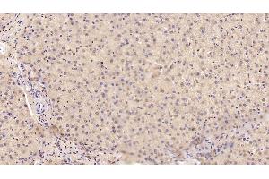 Detection of MANF in Human Liver Tissue using Monoclonal Antibody to Mesencephalic Astrocyte Derived Neurotrophic Factor (MANF) (MANF antibody  (AA 28-182))