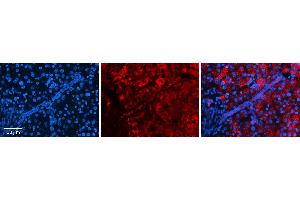 Rabbit Anti-STAT1 Antibody   Formalin Fixed Paraffin Embedded Tissue: Human Liver Tissue Observed Staining: Cytoplasm in hepatocytes Primary Antibody Concentration: 1:100 Other Working Concentrations: N/A Secondary Antibody: Donkey anti-Rabbit-Cy3 Secondary Antibody Concentration: 1:200 Magnification: 20X Exposure Time: 0. (STAT1 antibody  (C-Term))