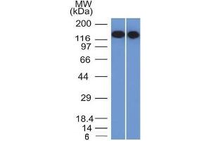 Western Blot Analysis of Raji and Ramos cell lysates using CD22-Monospecific Mouse Monoclonal Antibody (BLCAM/1795). (CD22 antibody  (AA 52-178))