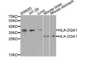 Western blot analysis of extracts of various cell lines, using HLA-DQA1 antibody. (HLA-DQA1 antibody  (AA 24-216))