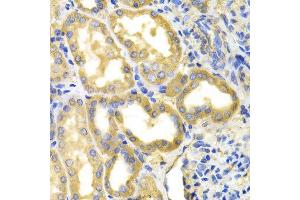 Immunohistochemistry (IHC) image for anti-Dihydropyrimidine Dehydrogenase (DPYD) (AA 1-173) antibody (ABIN3022259) (DPYD antibody  (AA 1-173))