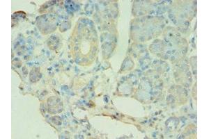 Immunohistochemistry of paraffin-embedded human pancreatic tissue using ABIN7145118 at dilution of 1:100 (ATG9B antibody  (AA 715-924))