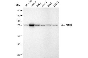 Western blotting analysis using RRM1 antibody (ABIN7800212).