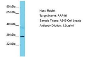 Image no. 1 for anti-Ribosomal RNA Processing 15 Homolog (RRP15) (AA 202-251) antibody (ABIN6750605)