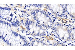 Detection of FAS in Human Colon Tissue using Polyclonal Antibody to Factor Related Apoptosis (FAS) (FAS antibody)