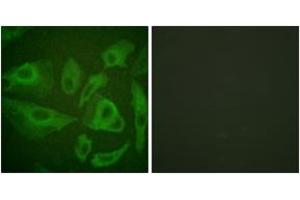 Immunofluorescence analysis of HeLa cells, using FAS (Ab-291) Antibody.