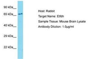 Image no. 1 for anti-Electron-Transferring-Flavoprotein Dehydrogenase (ETFDH) (AA 201-250) antibody (ABIN6750434)