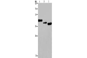 Western Blotting (WB) image for anti-Cysteine-Rich, Angiogenic Inducer, 61 (CYR61) antibody (ABIN2429877) (CYR61 antibody)