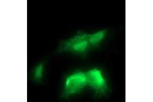 Image no. 5 for anti-V-Ral Simian Leukemia Viral Oncogene Homolog B (Ras Related, GTP Binding Protein) (Ralb) antibody (ABIN1500584) (RALB antibody)
