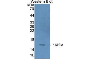 Western blot analysis of recombinant Human PKIg.