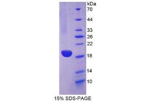 SDS-PAGE (SDS) image for Lactalbumin, alpha- (LALBA) (AA 12-142) protein (His tag) (ABIN2123988)