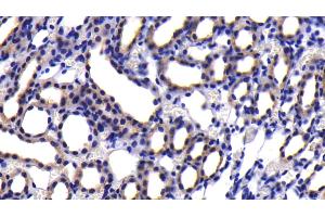 Immunohistochemistry (IHC) image for anti-Caspase 9, Apoptosis-Related Cysteine Peptidase (CASP9) (AA 1-200) antibody (ABIN7432250)
