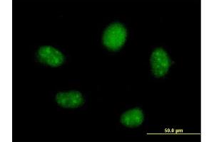 Immunofluorescence of  purified  MaxPab antibody to FTSJ2 on HeLa cell.