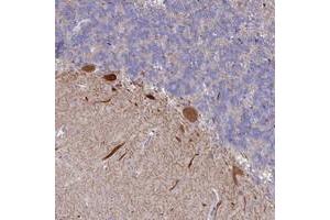 Immunohistochemical staining of human cerebellum with WDR76 polyclonal antibody  shows strong cytoplasmic positivity in purkinje cells at 1:50-1:200 dilution. (WDR76 antibody)