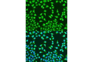 Immunofluorescence analysis of U2OS cells using MT-CO2 antibody (ABIN6294175) at dilution of 1:100.