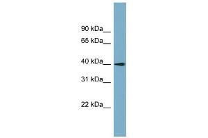 SLC25A22 antibody used at 1 ug/ml to detect target protein. (SLC25A22 antibody)