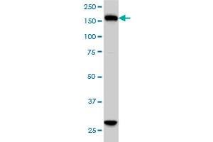 KIF15 monoclonal antibody (M01), clone 4D4 Western Blot analysis of KIF15 expression in HeLa . (KIF15 antibody  (AA 1279-1385))