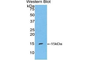 Detection of Recombinant S100A7, Mouse using Polyclonal Antibody to S100 Calcium Binding Protein A7 (S100A7) (S100A7 antibody  (AA 1-108))