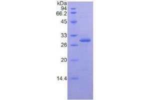 SDS-PAGE analysis of Human IkBe Protein. (Inhibitory Subunit of NF-KappaB epsilon Protein)