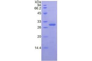 Inhibitory Subunit of NF-KappaB epsilon protein