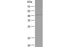 Western Blotting (WB) image for Fibrinogen gamma Chain (FGG) (AA 27-437) protein (His tag) (ABIN7122911) (FGG Protein (AA 27-437) (His tag))