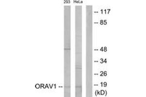 Western blot analysis of extracts from 293/HeLa cells, using ORAV1 Antibody. (ORAOV1 antibody  (AA 81-130))