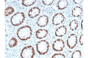 Immunohistochemistry (IHC) image for anti-Minichromosome Maintenance Complex Component 6 (MCM6) (AA 228-368) antibody (ABIN6940016)